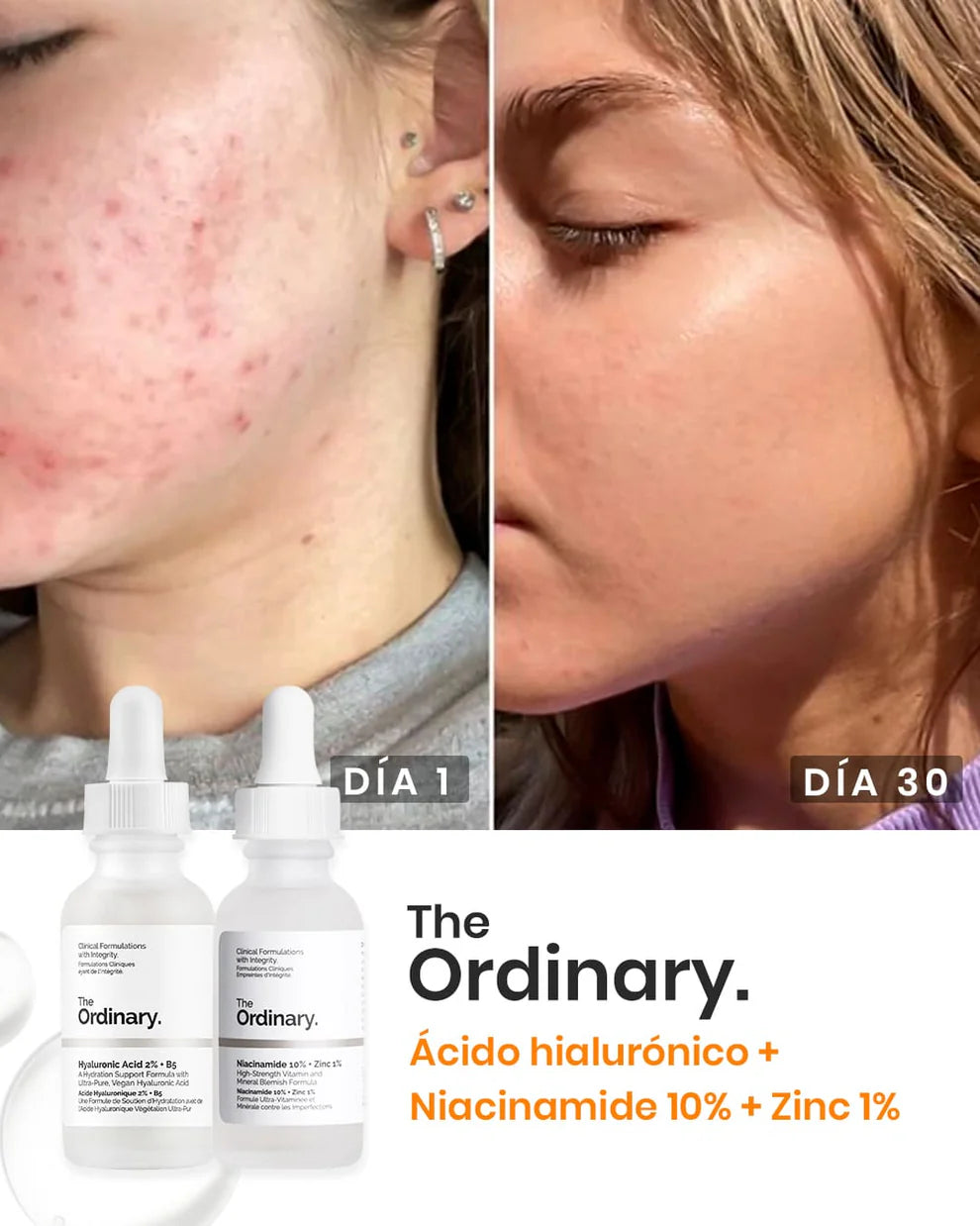 Combo The Ordinary: Ácido Hialurónico + Niacinamida - Envío Gratis