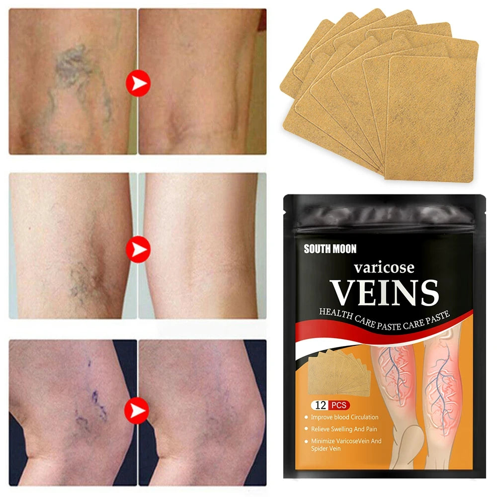 Parches Anti Varices - 24 parches + ¡12 de REGALO!