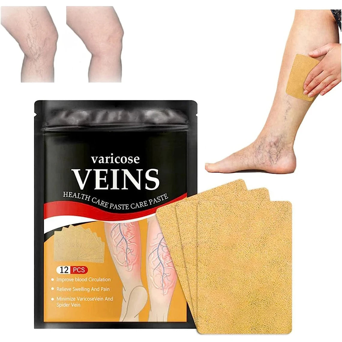Parches Anti Varices - 24 parches + ¡12 de REGALO!