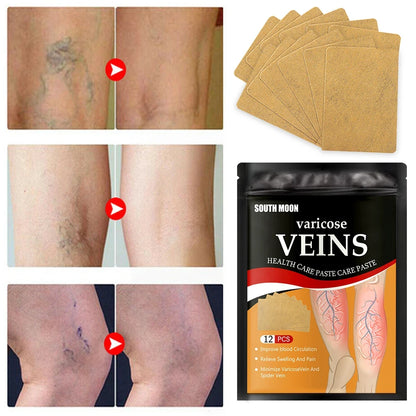 Parches Anti Varices - 24 parches + ¡12 de REGALO!
