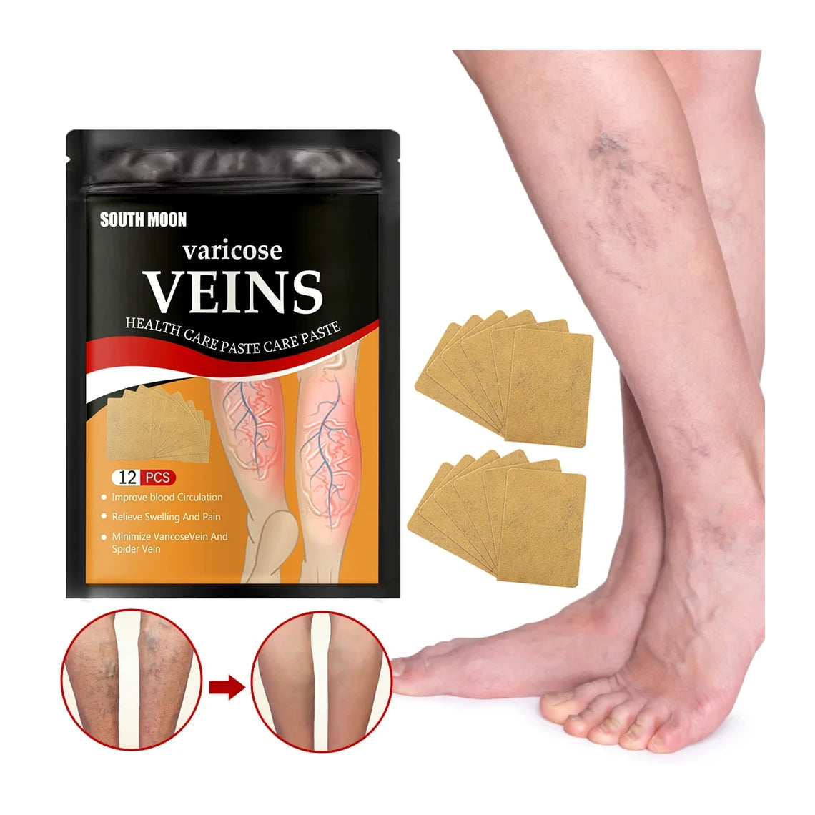 Parches Anti Varices - 24 parches + ¡12 de REGALO!
