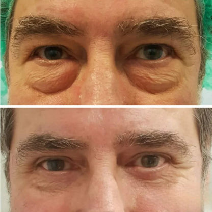 Contorno De Ojos Roll-on BIOAQUA